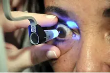 Göz Tansiyonu Kaç Olmalı?